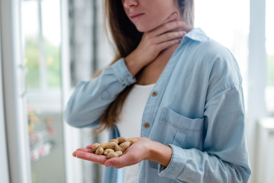 Frau mit Erdnussallergie