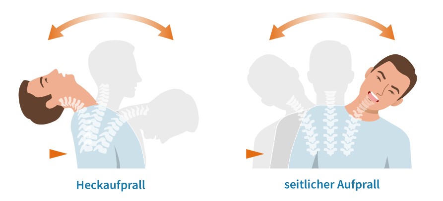 Grafik Schleudertrauma, Heckaufprall, seitlicher Aufprall