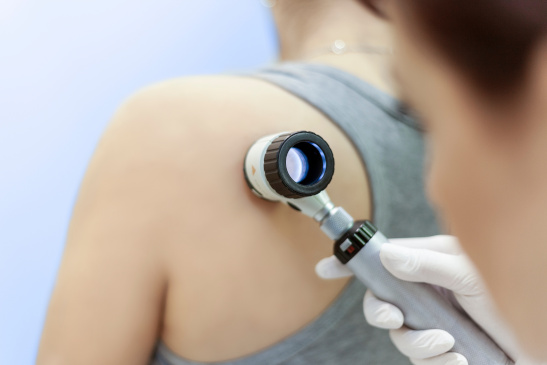Ärztin untersucht Haut einer Frau mit einem Dermatoskop